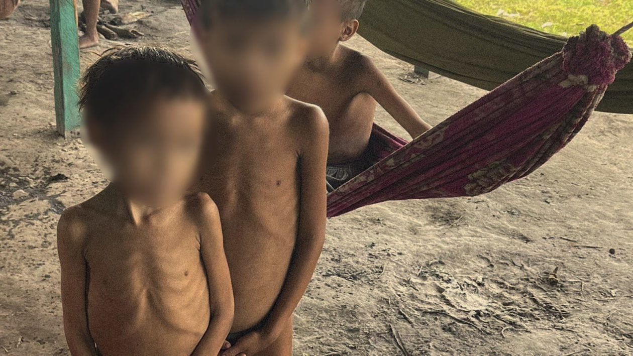 Malnourished Yanomamai Children